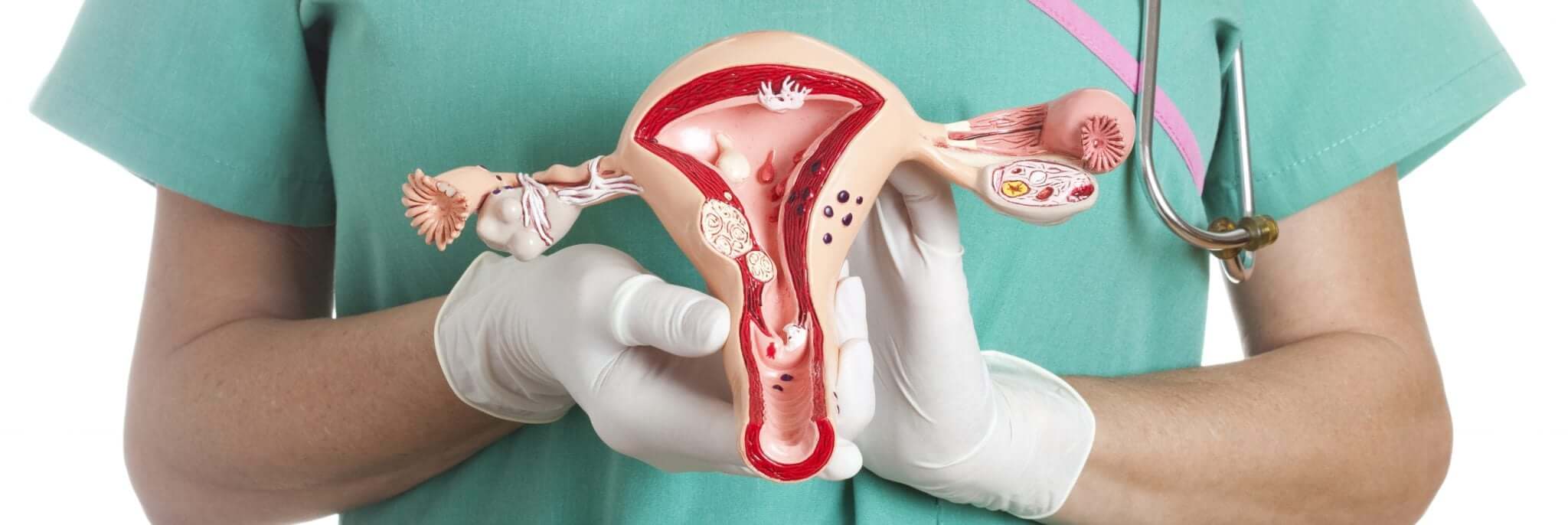 Эндометриоз: почему боль при месячных — это не норма и что с этим делать